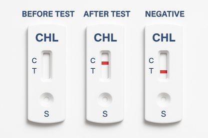 Chlamydia Home Test Kit